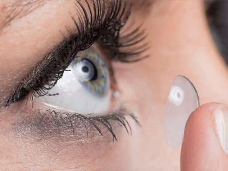 portfolio-gaus-contactlinsenanpassung