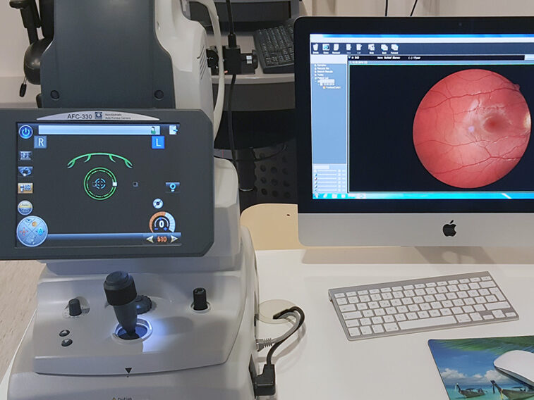 Netzhaut-Screening mit Funduskamera Netzhaut-Screening mit Funduskamera